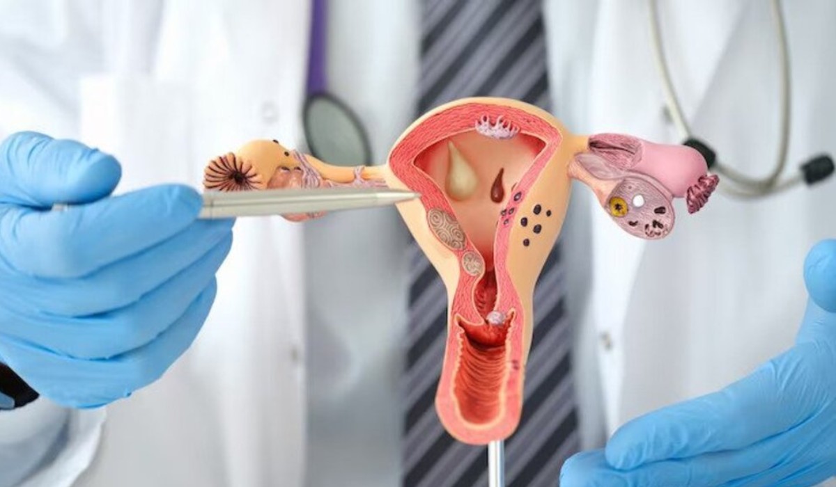Female Urology 1